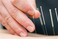 Akupunktur-1.jpg